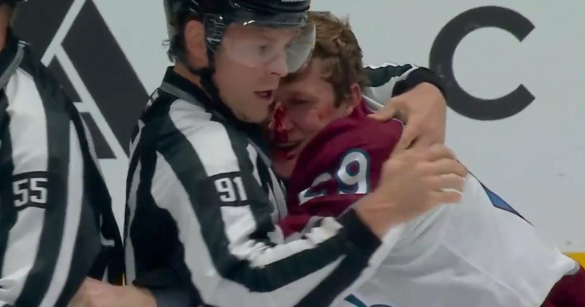 A bloody Nathan MacKinnon.