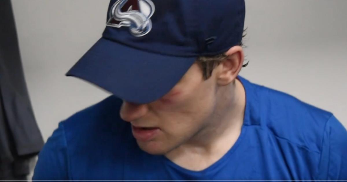 Nathan MacKinnon