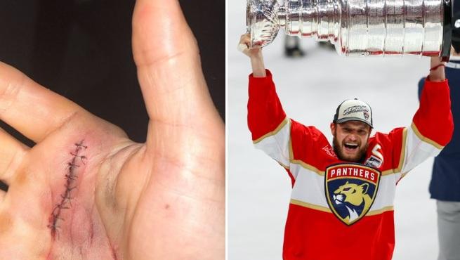 Aleksander Barkov