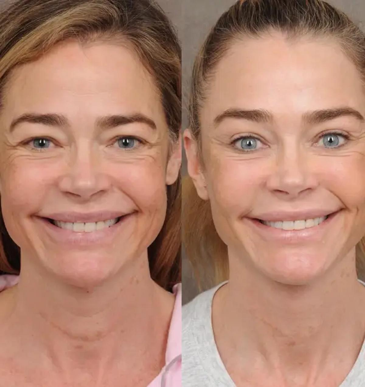 Source photo: Instagram/@drbentalei