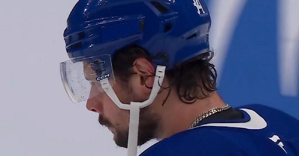 Matthews