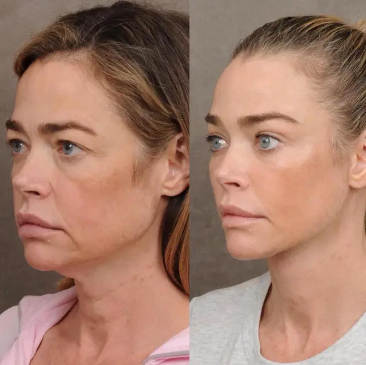 Source photo: Instagram/@drbentalei