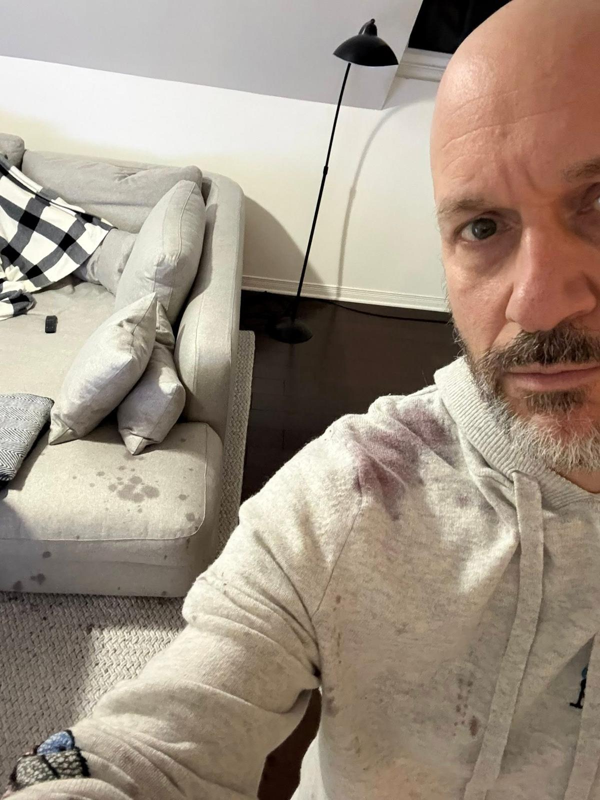 Martin Matte vit une mésaventure à son chalet