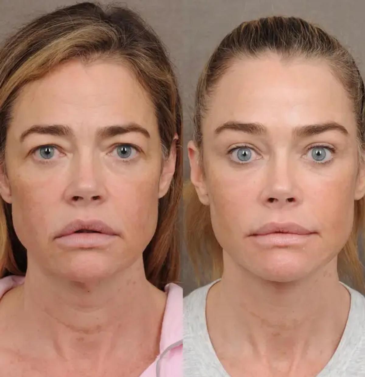 Source photo: Instagram/@drbentalei