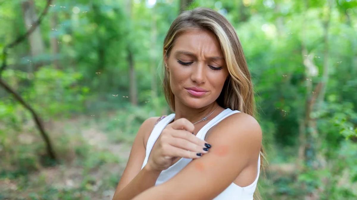 Femme allergique piqûre