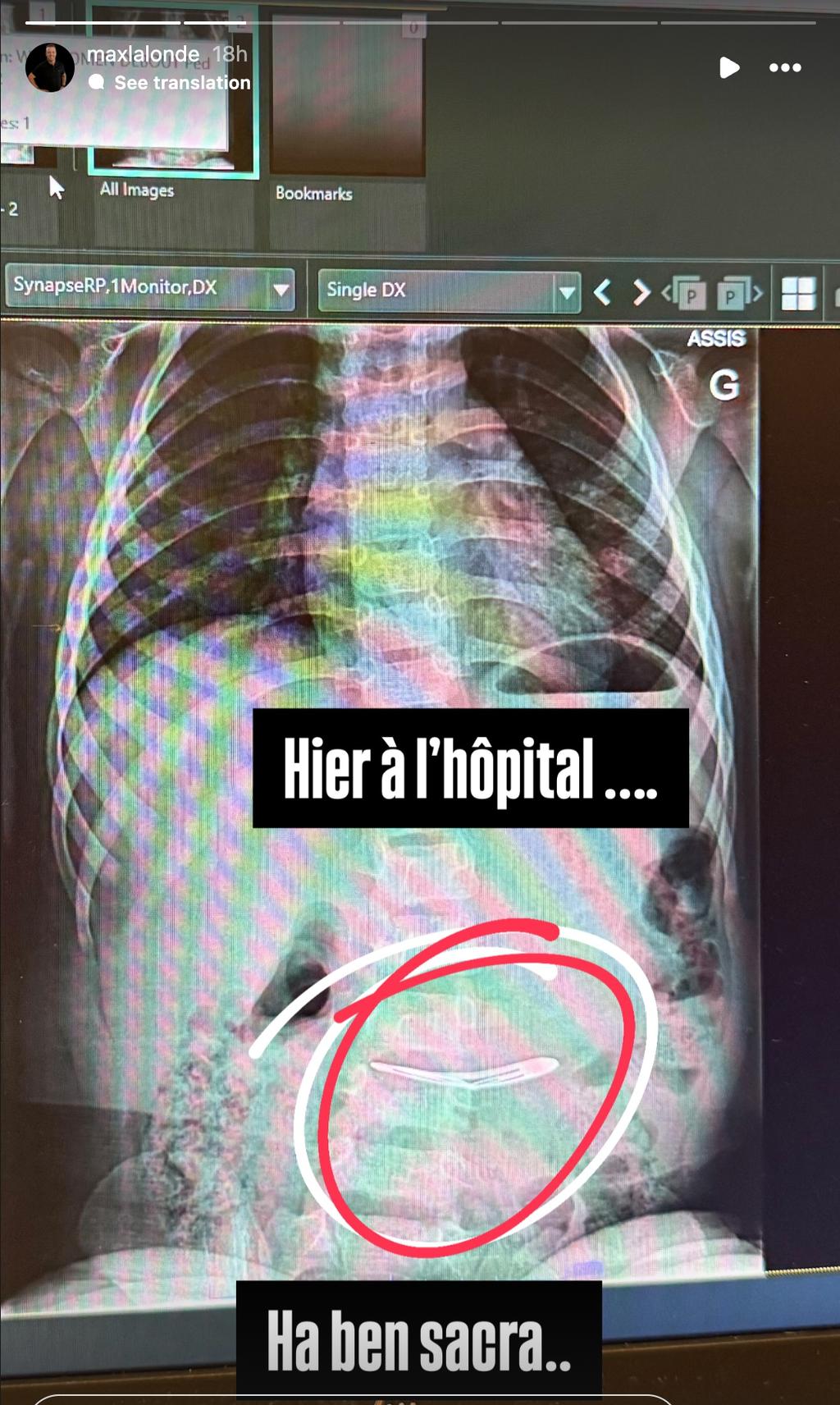Radiographie