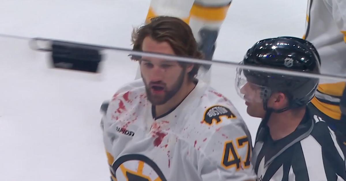 Mark Kastelic, bloodied.