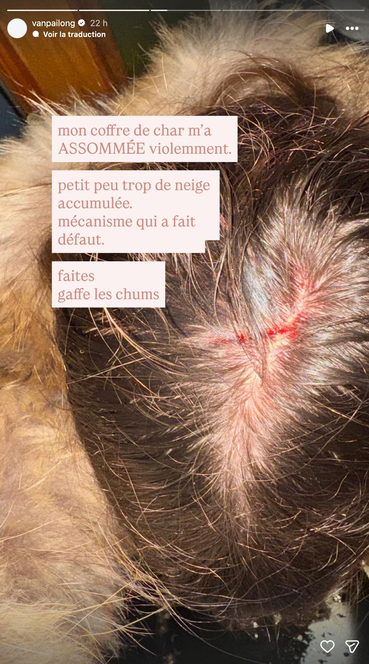 Vanessa Pilon s'est blessée à la tête