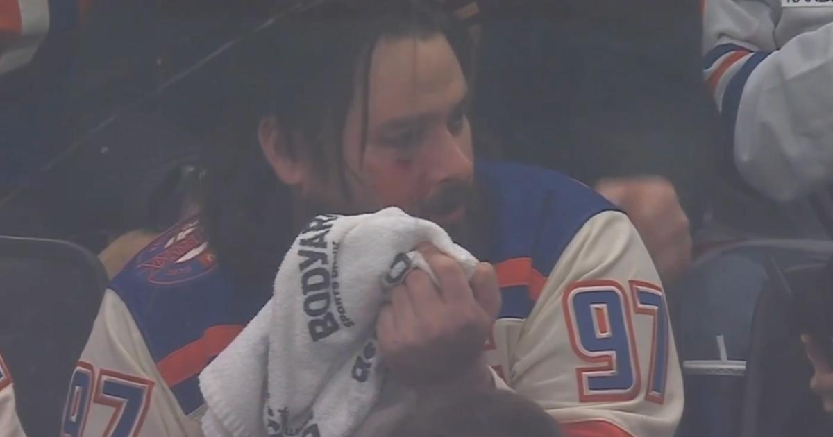 Oilers' fan.
