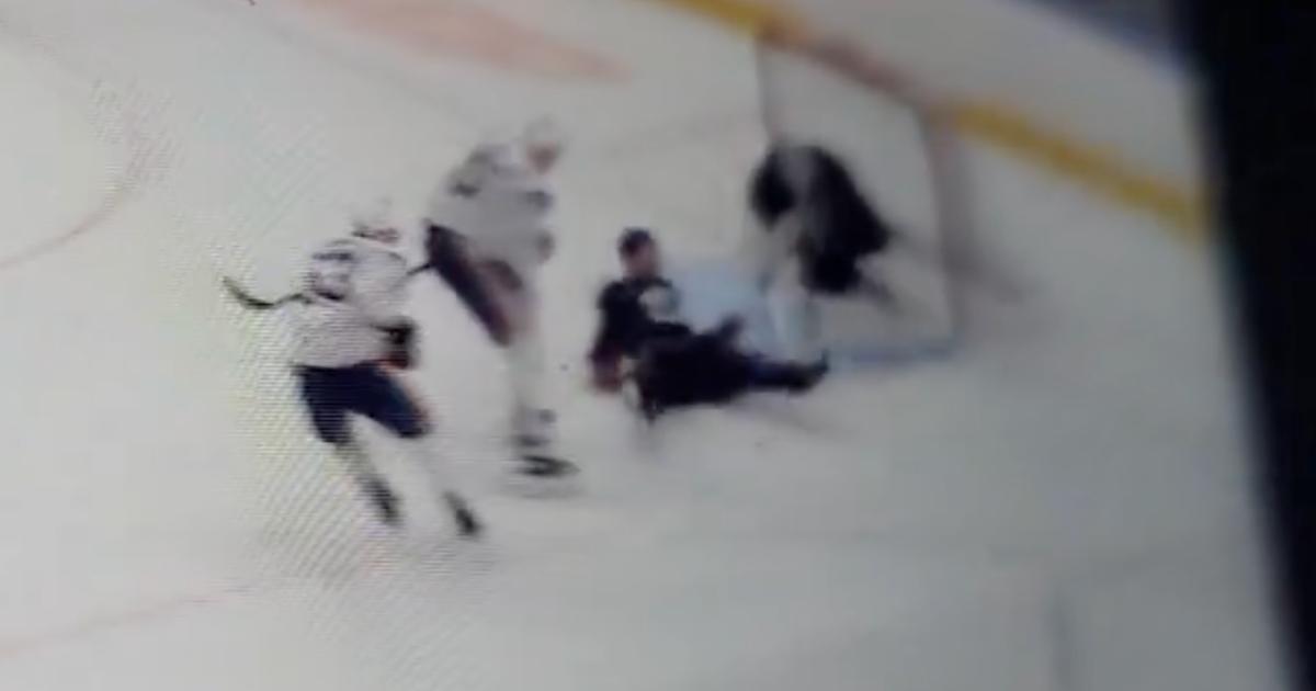 Connor McDavid, injury scare.