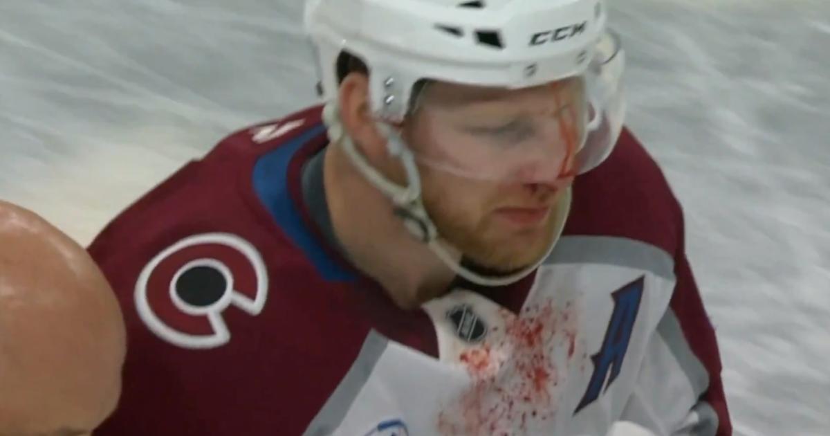 Bloody Nathan MacKinnon 