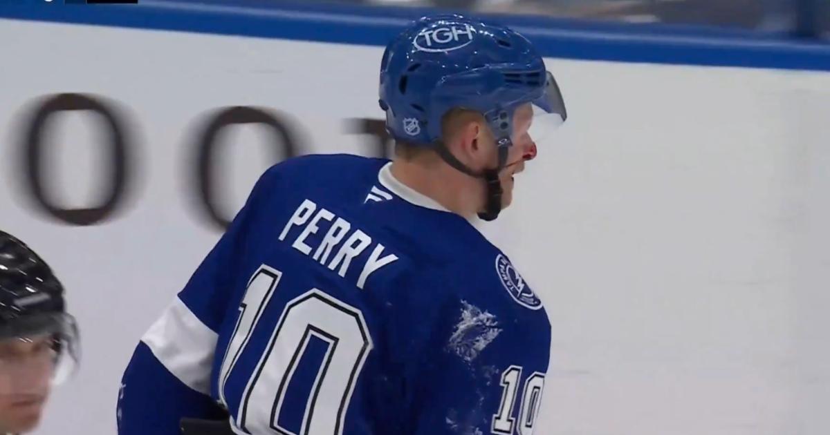 Corey Perry, bloodied. 