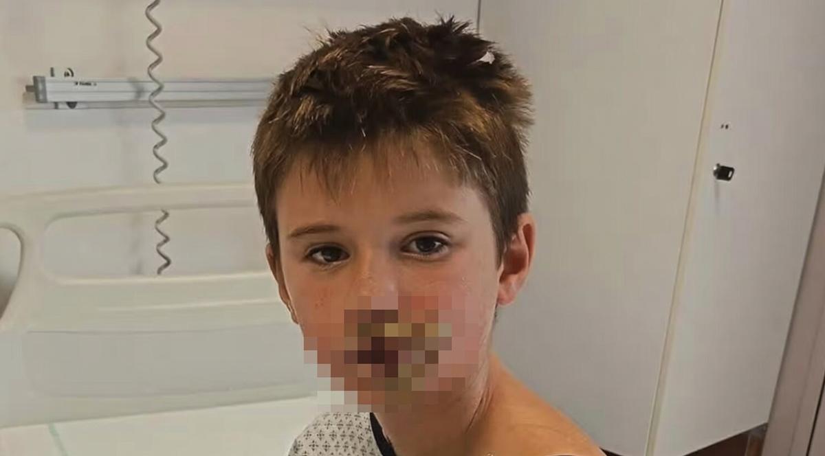 Un enfant de 8 ans brûlé par un jouet squishy